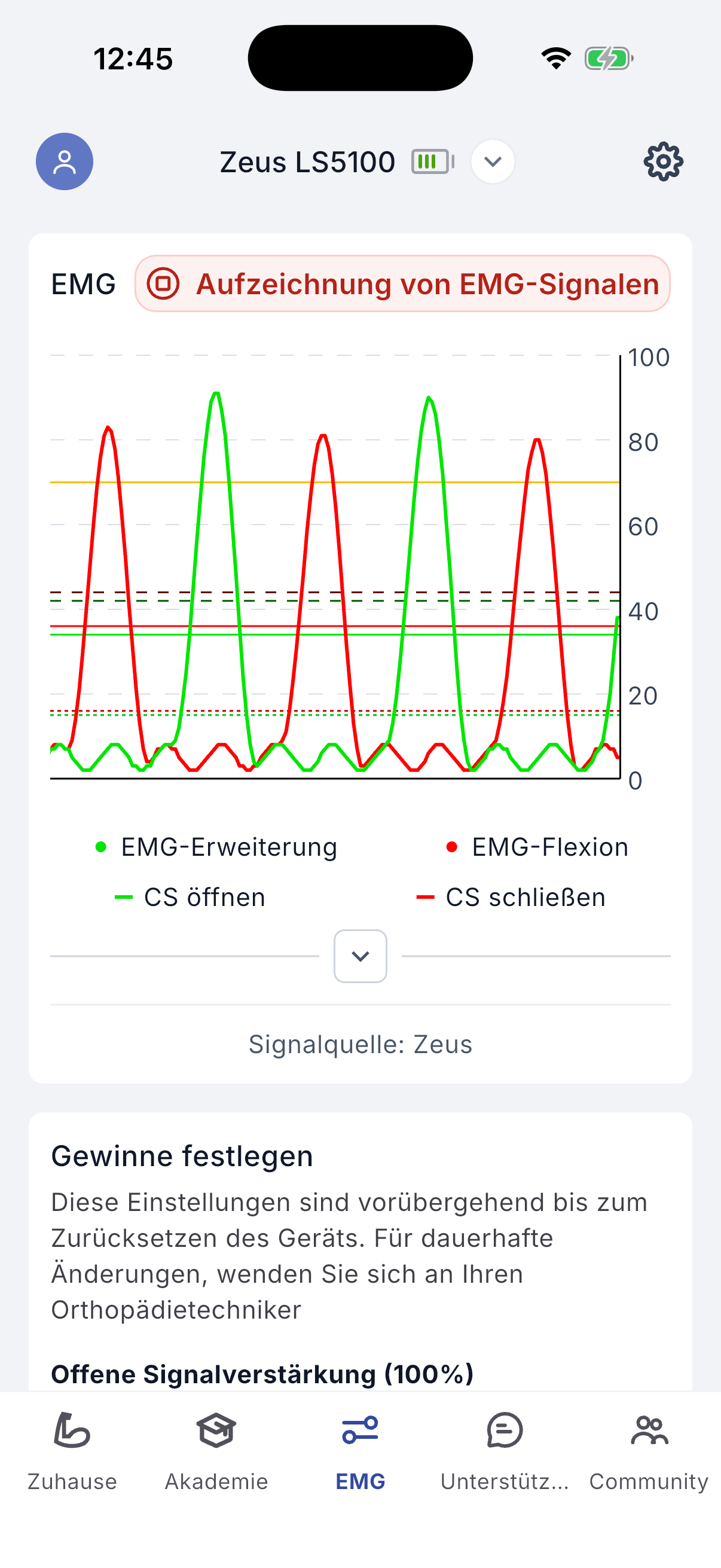 Recording EMG signals
