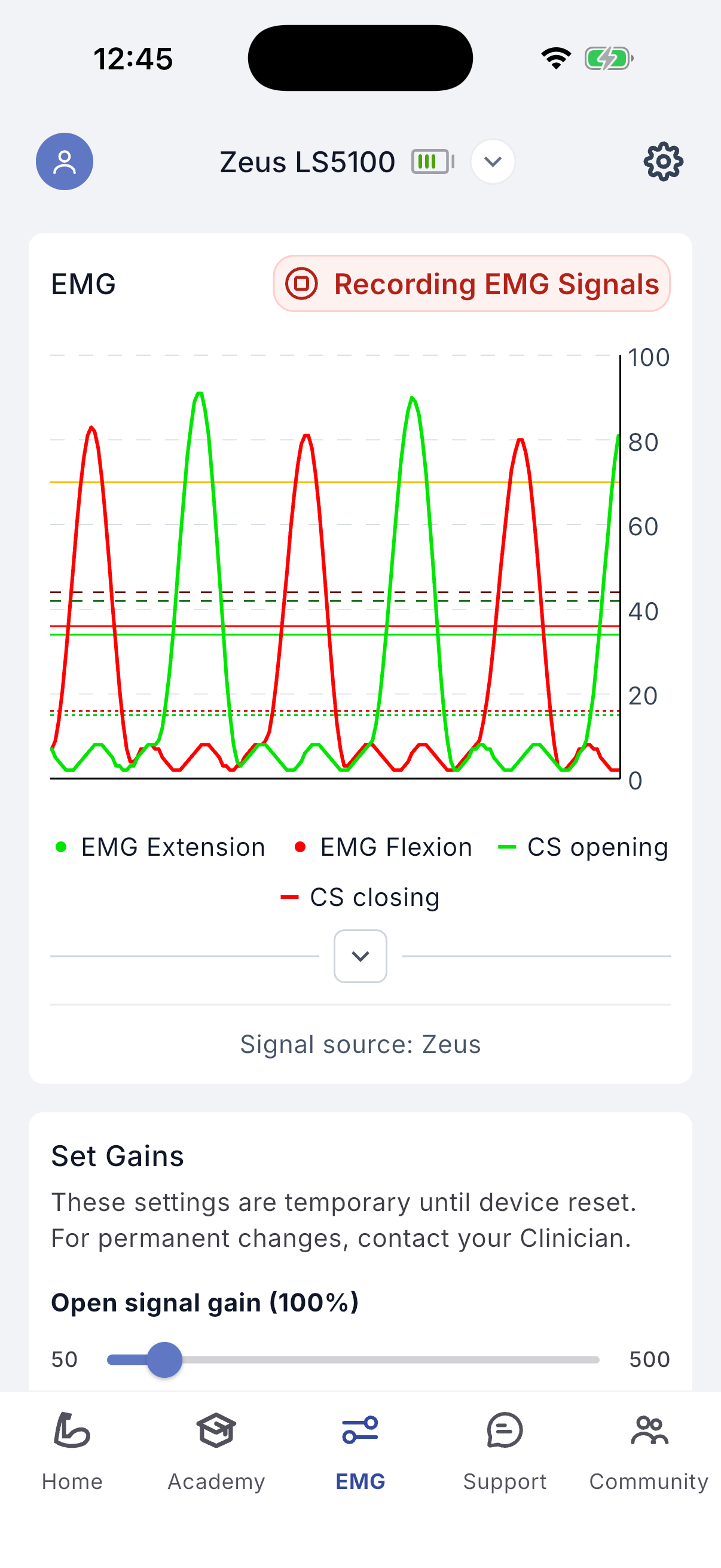 Recording EMG signals