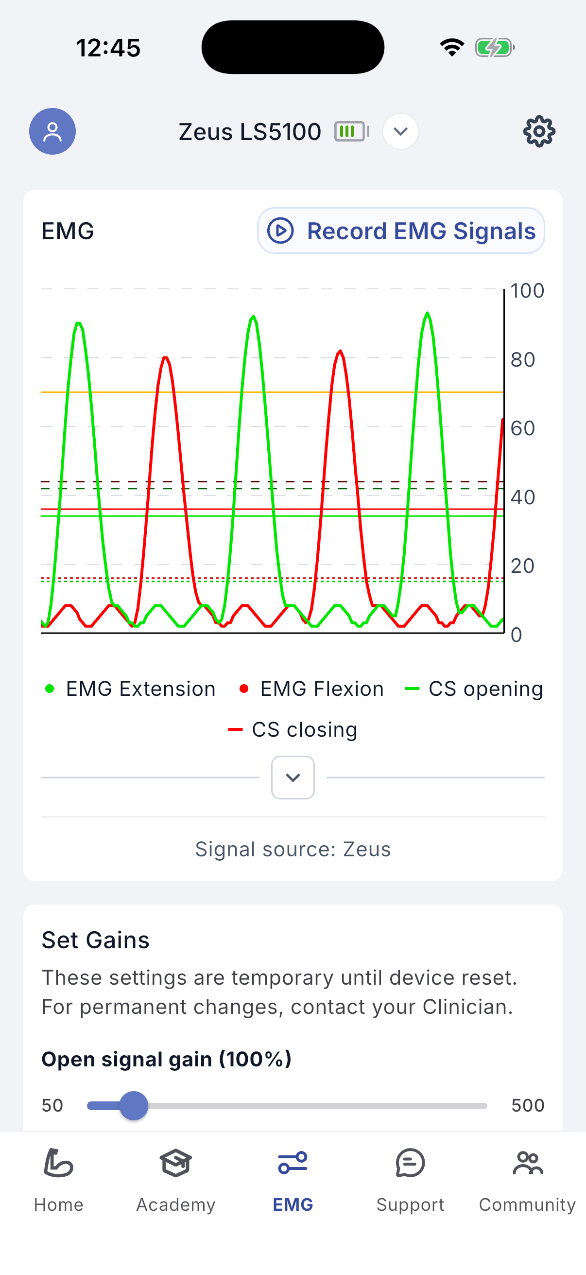 EMG signals screen