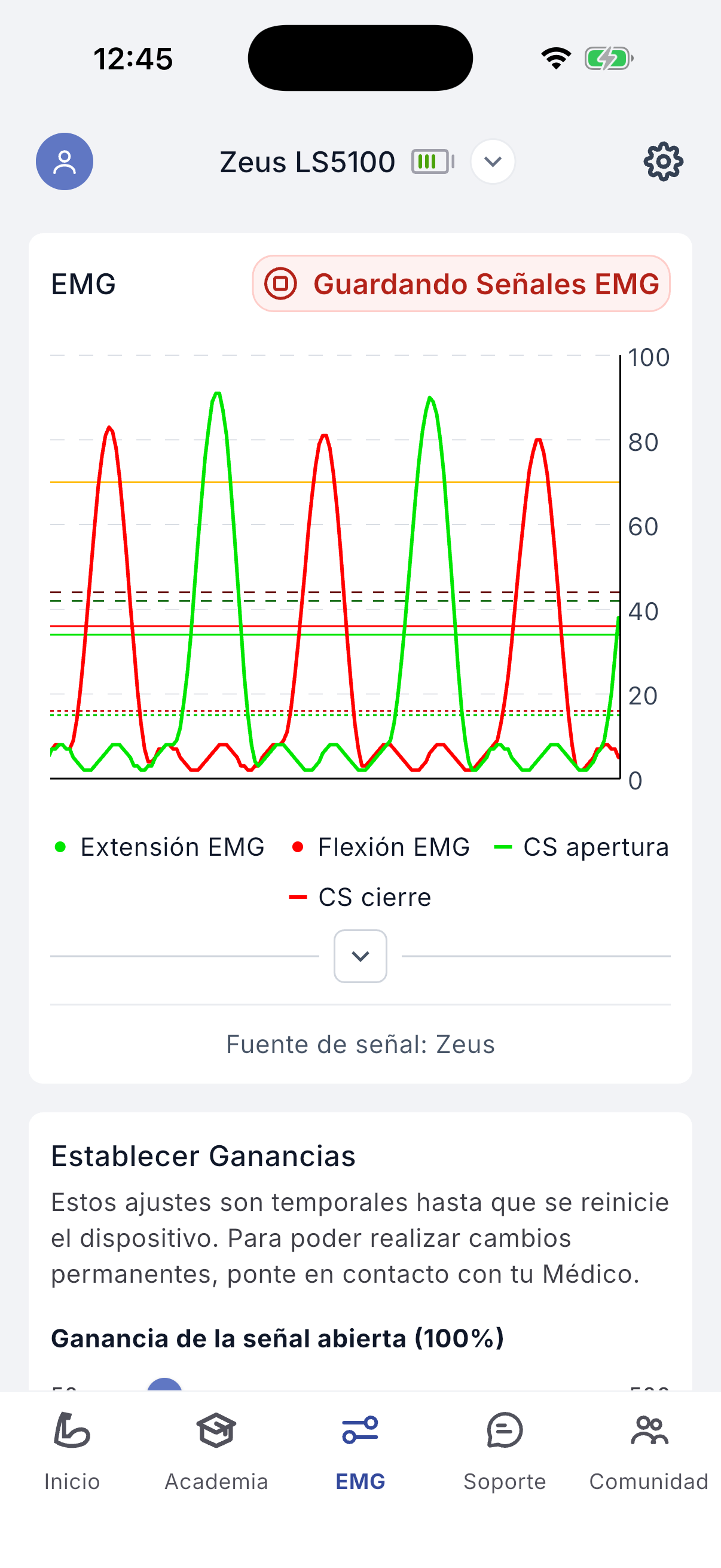 Recording EMG signals