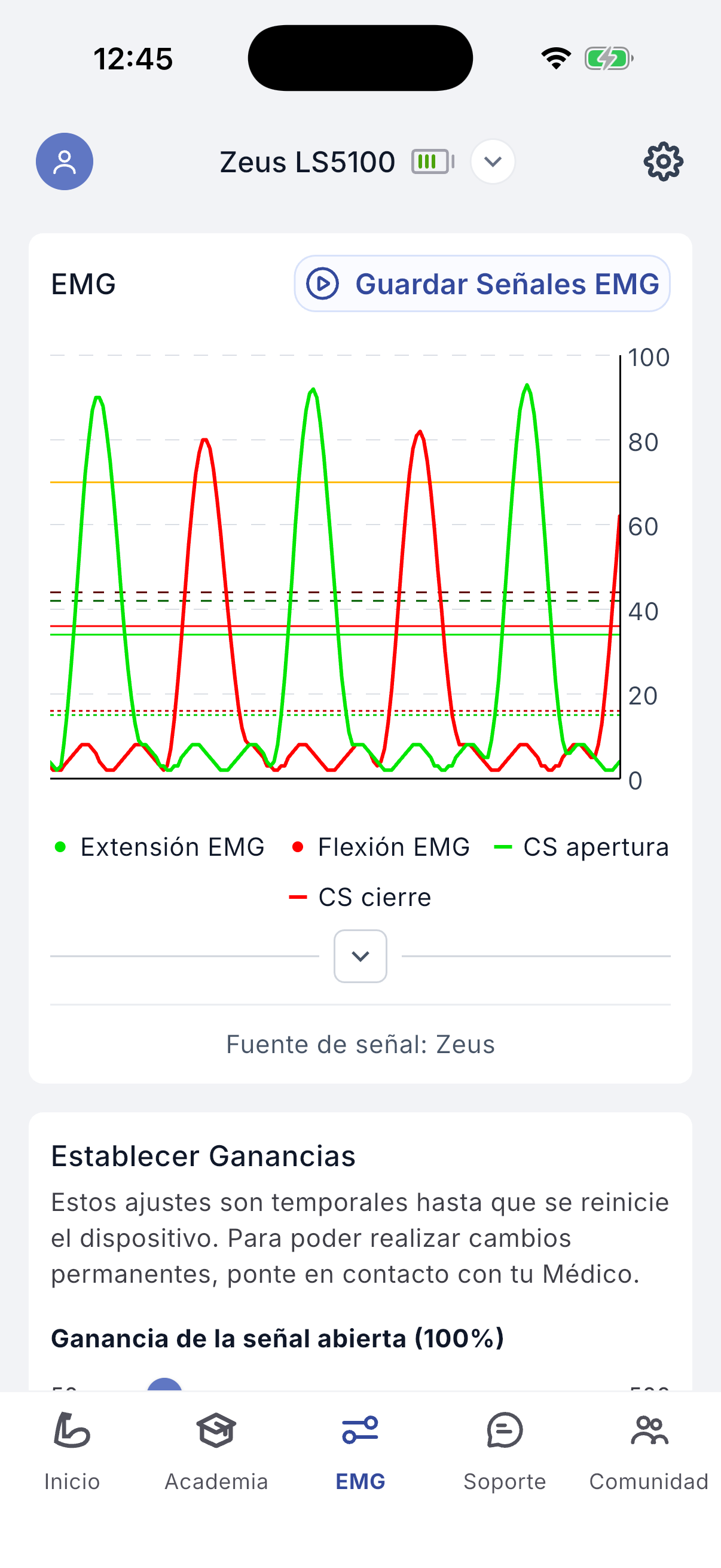 EMG signals screen