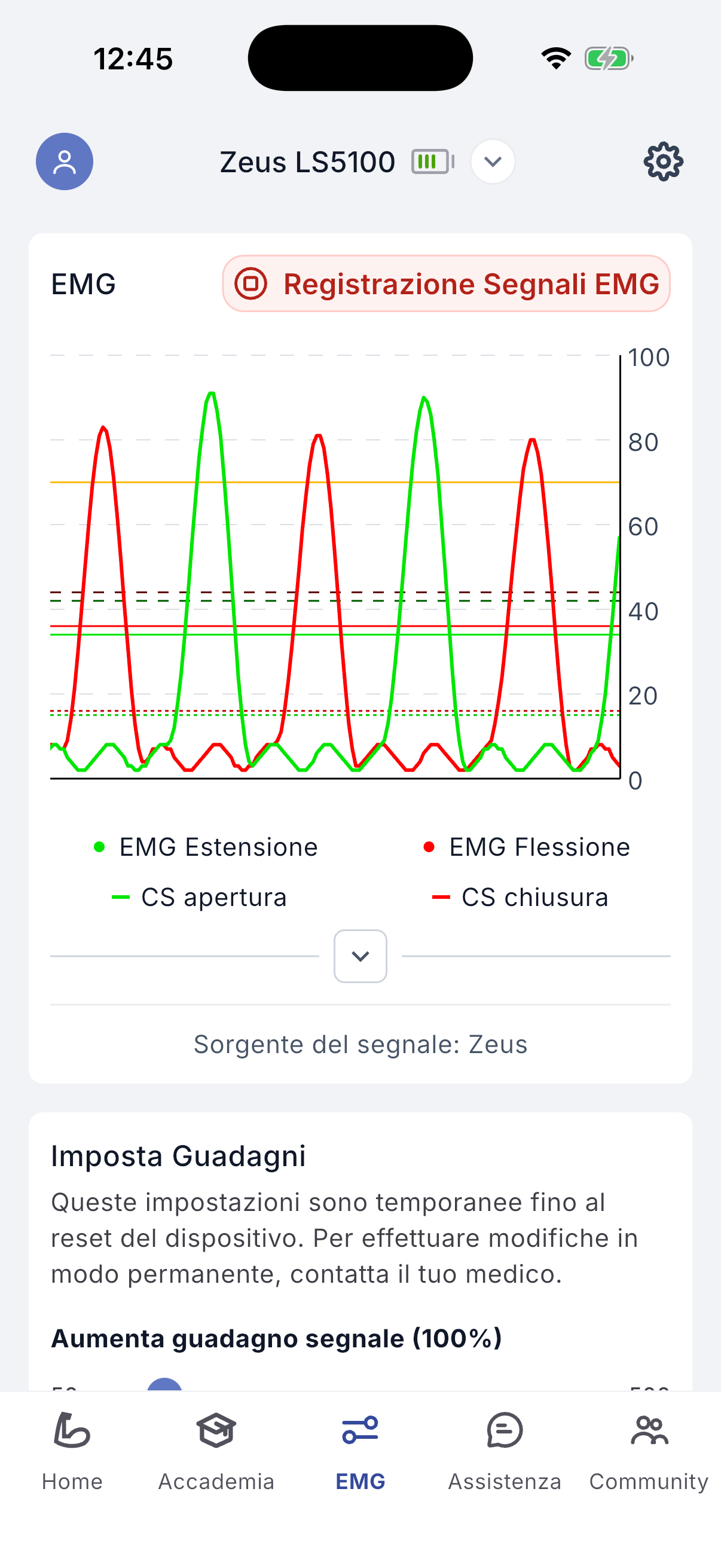 Recording EMG signals