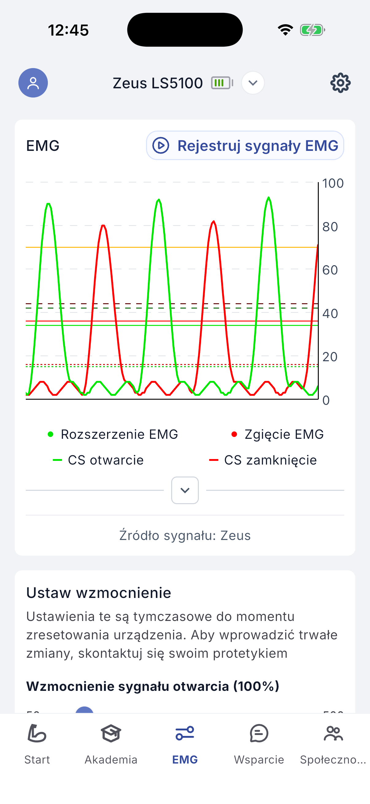 EMG signals screen