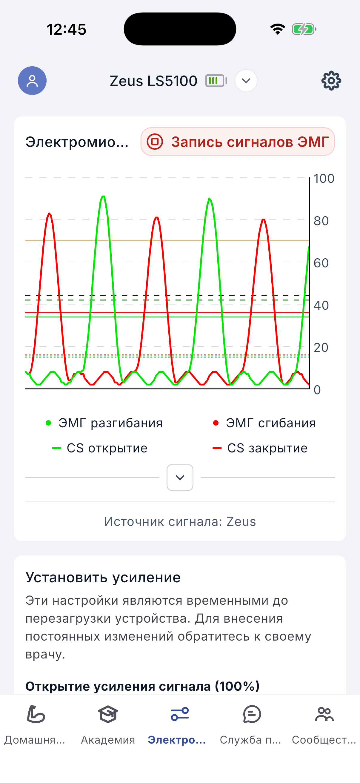 Recording EMG signals