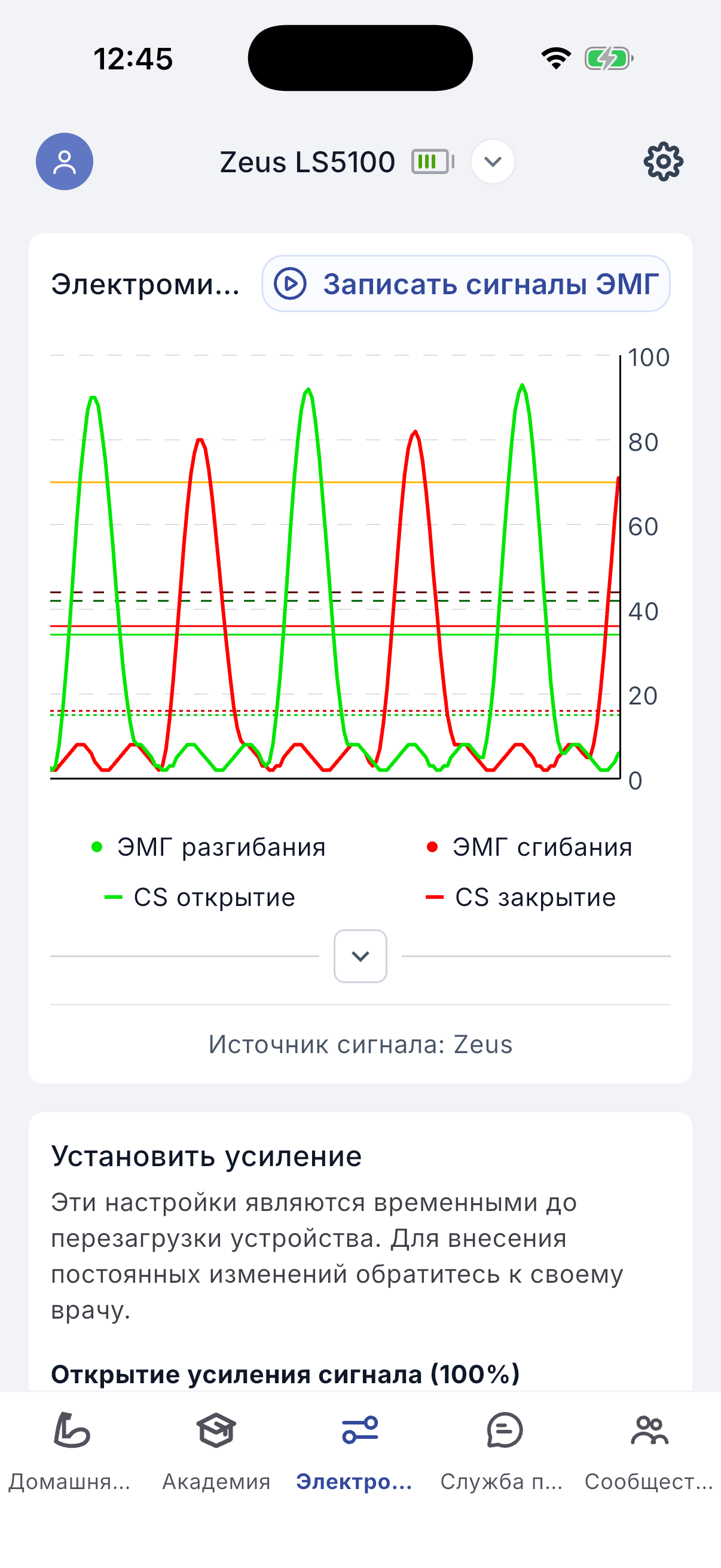 EMG signals screen