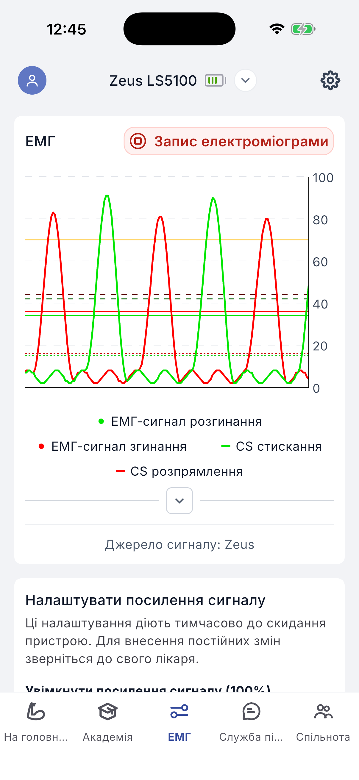 Recording EMG signals